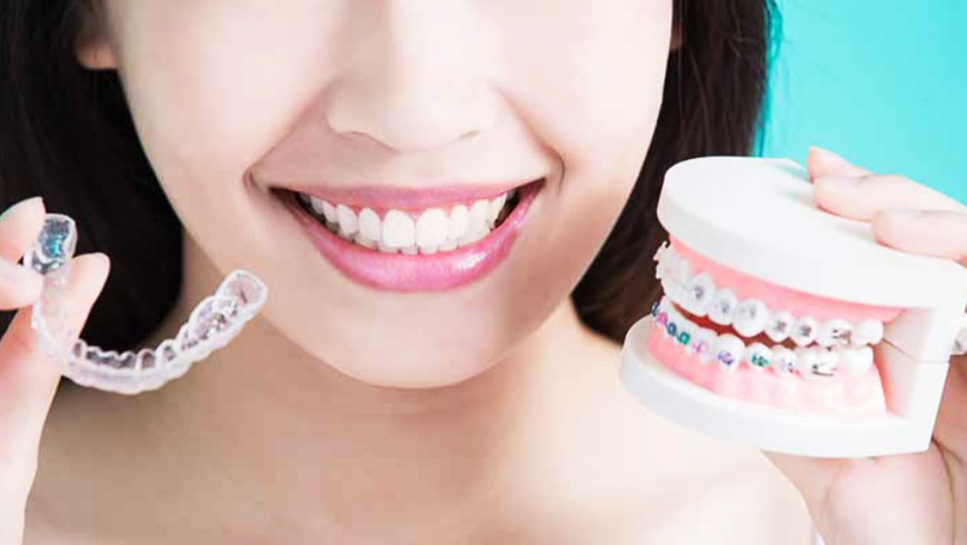 Instructions for Orthodontic Patients